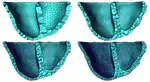 Adaptive Tetrahedral Meshing for Personalized Cardiac Simulations