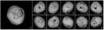 AutoImplant 2020 - First MICCAI Challenge on Automatic Cranial Implant Design