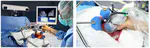 Automatic Calibration of 3D Ultrasound Probes