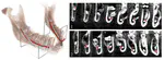 Automatic Extraction of Mandibular Nerve and Bone From Cone Beam CT Data