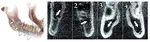 Automatische 3D-Rekonstruktion des Unterkiefers und der Mandibulärnerven auf Basis dentaler Bildgebung