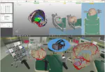 Clinical Benefits of Combining Different Visualization Modalities in Neurosurgery