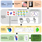 CT-based Analysis of Left Ventricular Hemodynamics Using Statistical Shape Modelling and Computational Fluid Dynamics