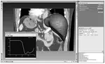 Ein Softwarepaket für die modellbasierte Segmentierung anatomischer Strukturen