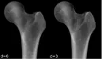 Fast and Accurate DRRs for X-Ray Based Joint Surgery Planning