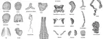 MedShapeNet - A Large Scale Dataset of 3D Medical Shapes for Computer Vision